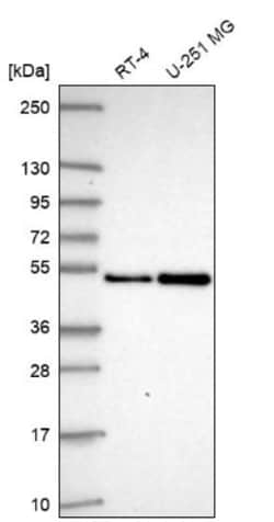 SAP30BP Antibody, Novus Biologicals 0.1mL; Unlabeled:Antibodies, Polyclonal